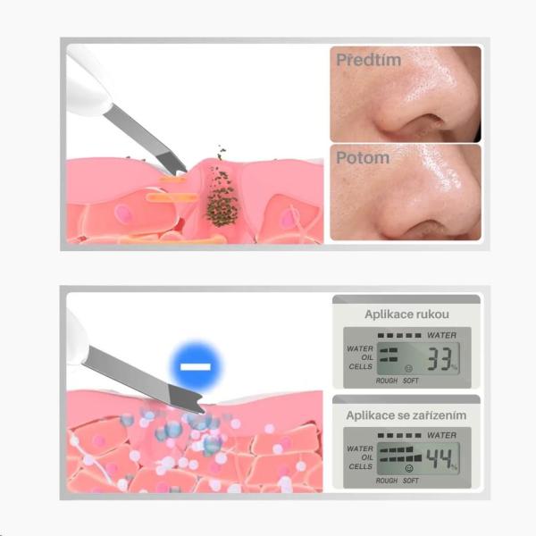 TOUCHBeauty 1887 Ultrazvuková špachtle na pleť0
